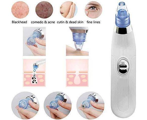 4 In 1 Black Head Remover Machine