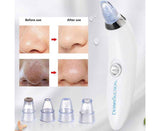 4 In 1 Black Head Remover Machine