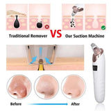 Blackhead Remover Pore Cleaner
